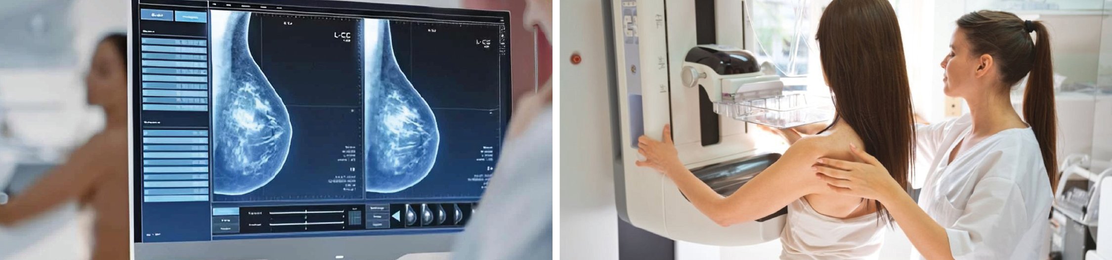Mamografia-1